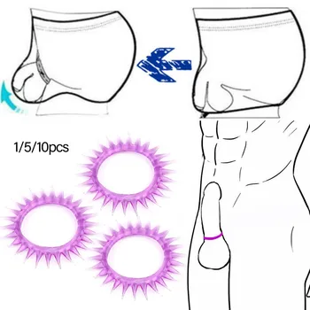 a péniszek minősítése thrombophlebitis a péniszben