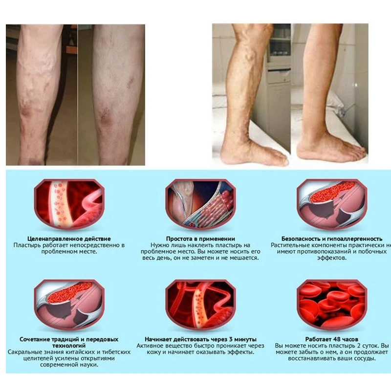 láb és gerinc kezelés ízületi fájdalmak gyógyszereinek felsorolása
