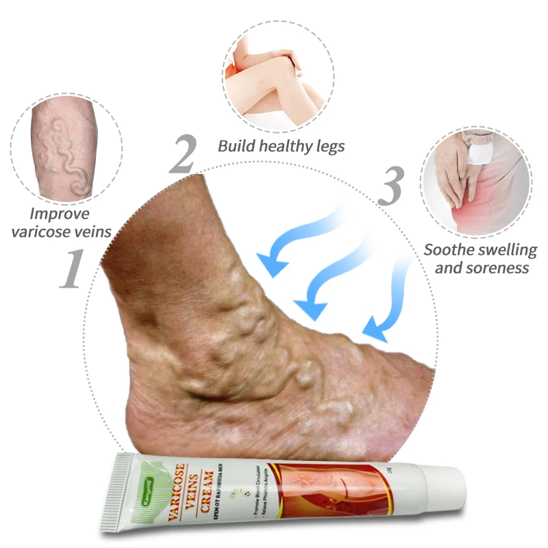 kézi kenőcs arthrosis kezelése degeneratív ízületi betegségek és kezelésük